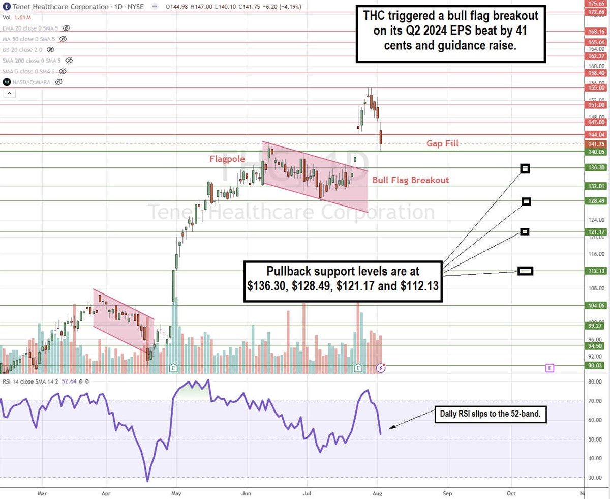 Tenet Healthcare THC stock chart