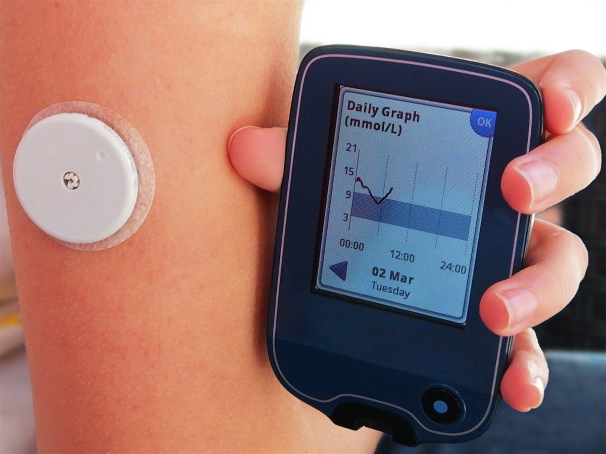 S&P 500 Component DexCom Set For Further Price, Earnings Growth