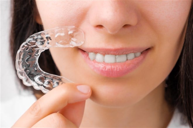 photo of smiling female holding align technology aligner