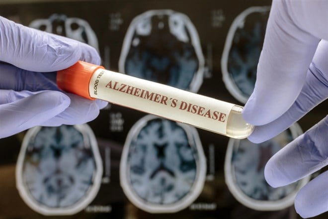 Alzheimer's blood test tube