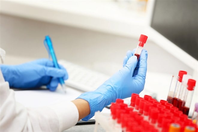 Scientist working with blood samples - stock image