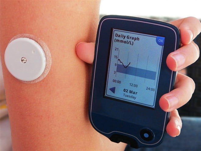 S&P 500 Component DexCom Set For Further Price, Earnings Growth