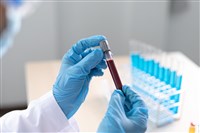 blood sample in vial