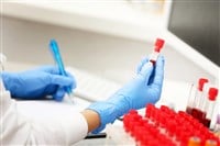 Scientist working with blood samples - stock image